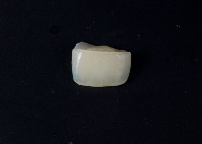 Reconstrucción biomimética de diente