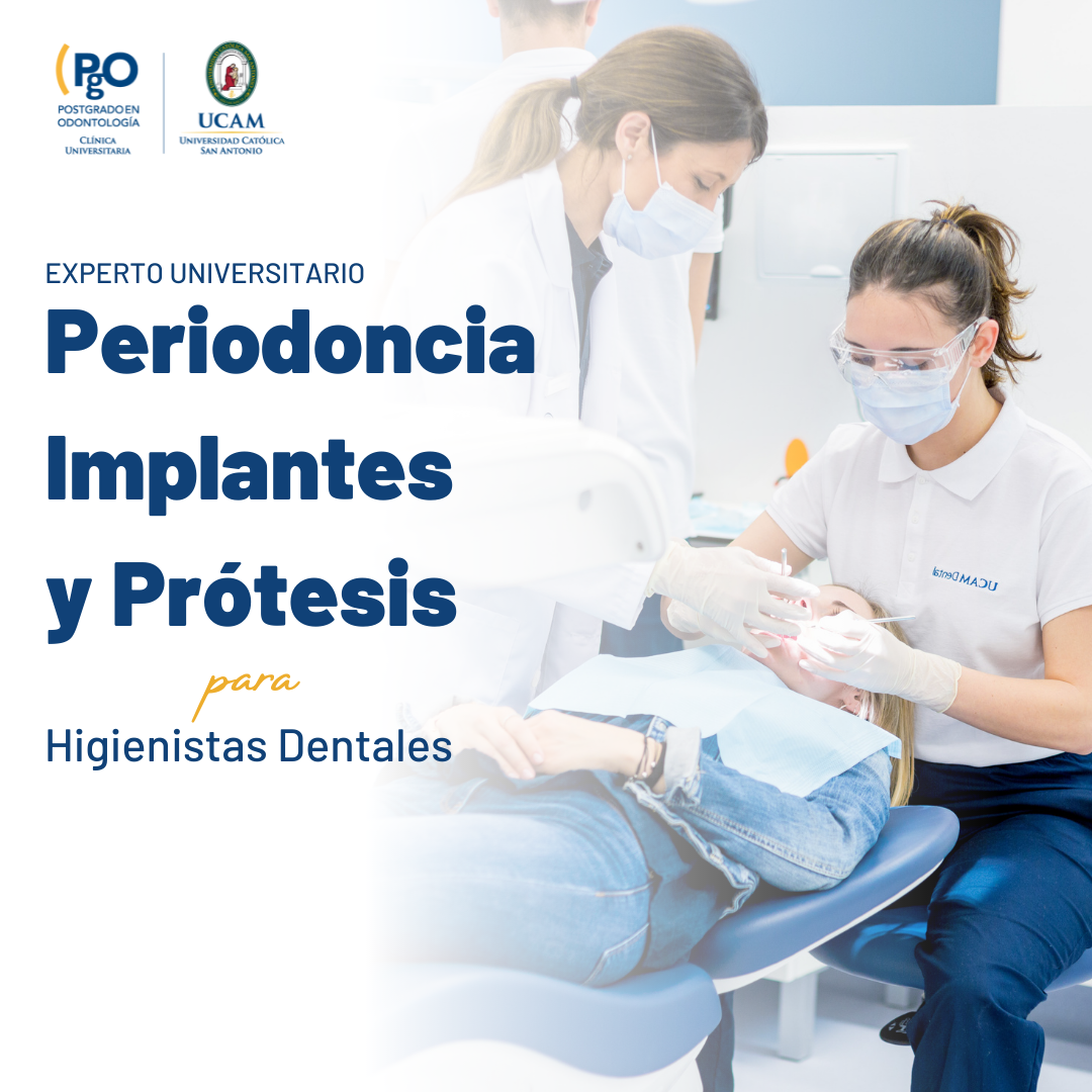 Periodoncia, Implantes Y Prótesis Para El Higienista Dental, La ...